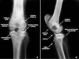 Lateral vs Medial Femoral Condyle on Lateral X-Ray in Horses