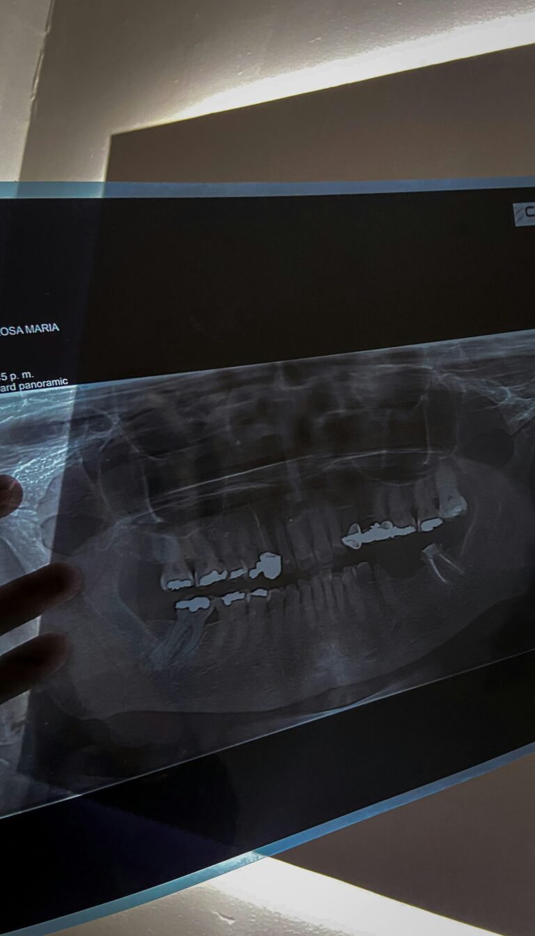 Panoramic Dental X-ray